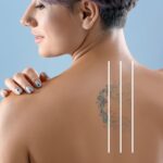 Understanding Scarring After Tattoo Removal: What to Know