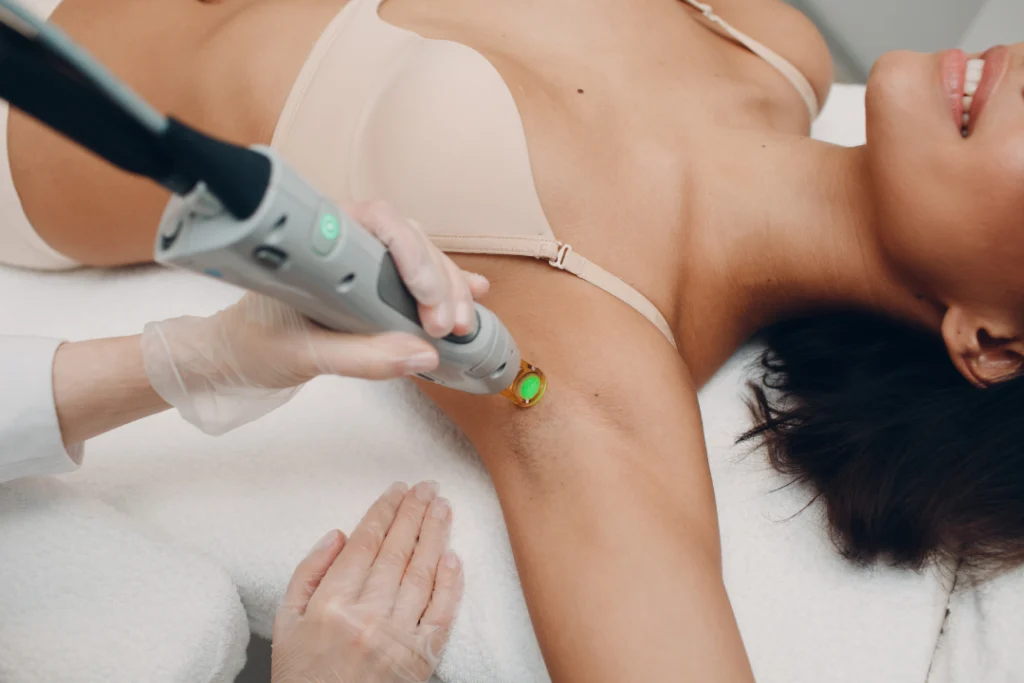 Technician performing laser hair removal on underarm for a client.