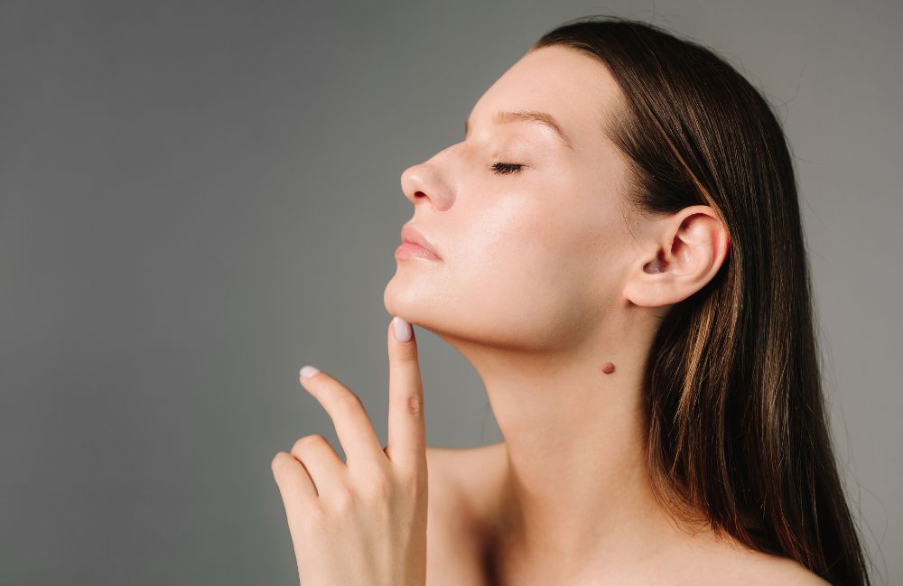 chin_filler_effects Close-up of a woman's neck showing visible platysmal bands before treatment.