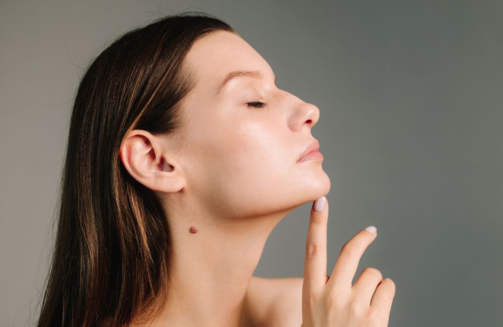 dysport_beautiful_and_confident Close-up of a woman's neck showing visible platysmal bands before treatment.