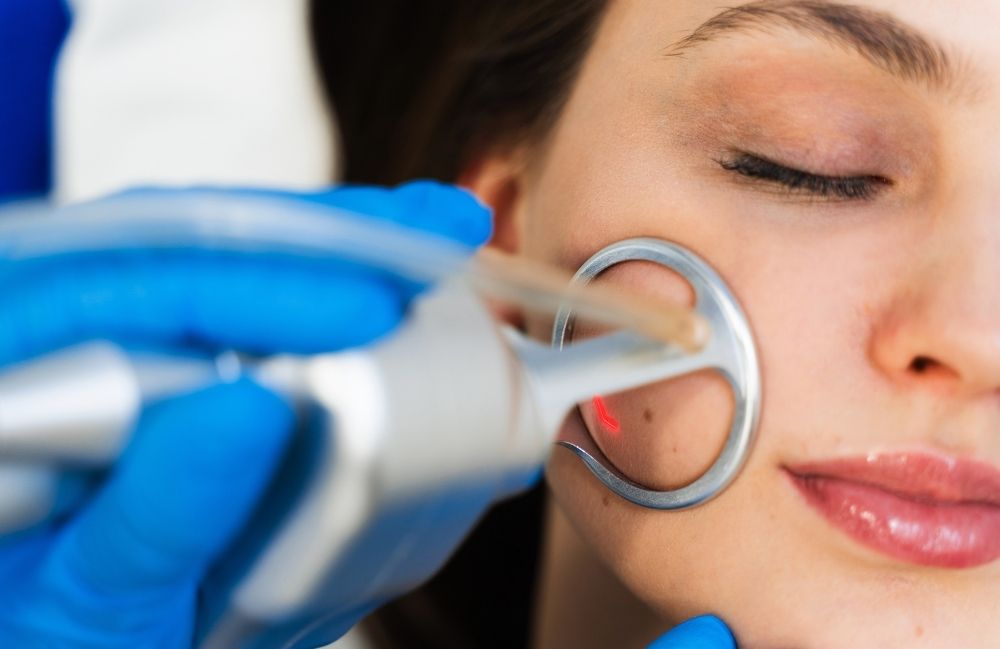 fractional-co2-laser-facial-treatment Close-up of a woman's neck showing visible platysmal bands before treatment.