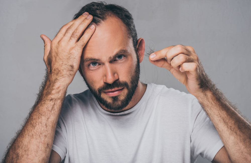 hair-loss-man-holding-hair Acne Scarring Metropolis Dermatology Los Angeles