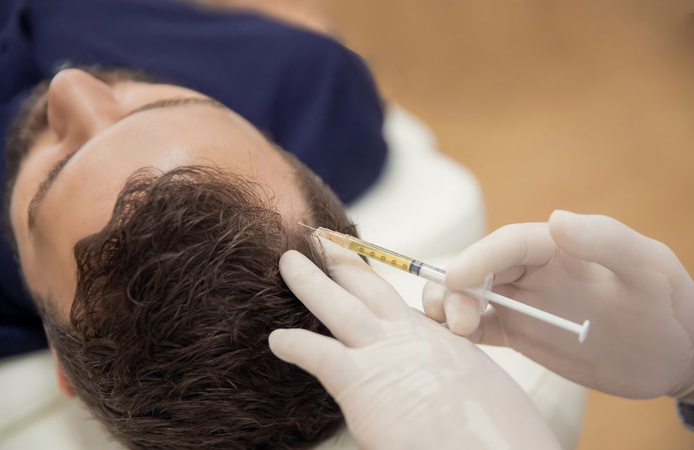 hair-loss-treatment-injection Acne Scarring Metropolis Dermatology Los Angeles