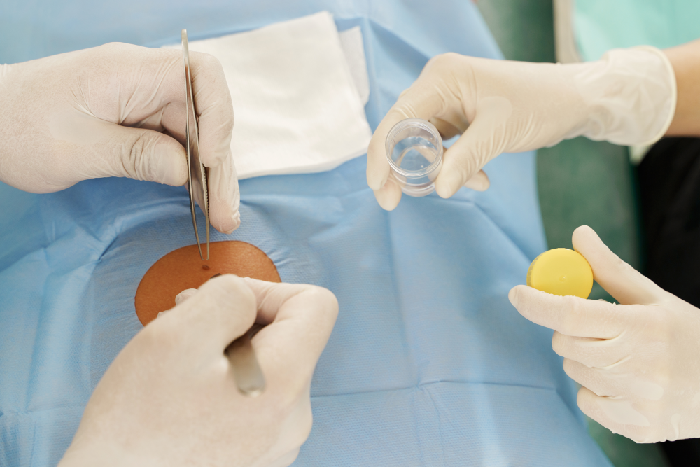 Doctors performing a skin cancer excision with surgical instruments.