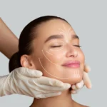 Why Everyone in LA Is Talking About Sculptra: The Collagen-Stimulating Filler That Lasts 2+ Years