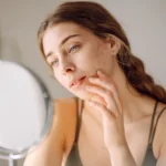 Why Summer Makes Acne Worse and the Treatments That Actually Clear It